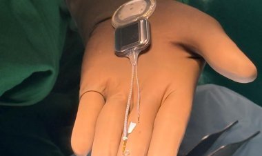 15 महीने की बच्ची को मिला दुनिया का पहला Nexa Smart Cochlear Implant